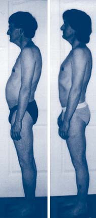 Structural Integration Rolfing