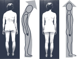 Structual Integration Rolfing